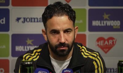 ARMONI Y LA DERROTA DEL MANUTD 27 SEP 2025